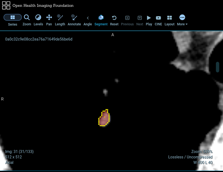 Screenshot of segmentation tool